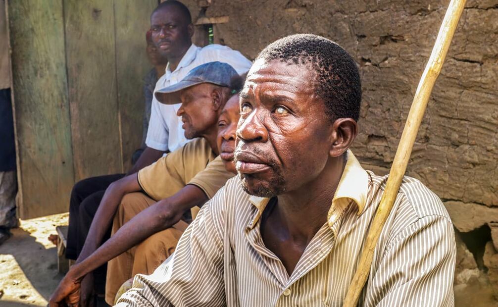 Paciente con ceguera por oncocercosis en África en 2018. De acuerdo con Ana Patricia Rodríguez, autora de Detección de Onchocerca volvulus, se estima que unos 37 millones de personas en todo el mundo fueron huéspedes del parásito. Foto: Wikimedia Commons.