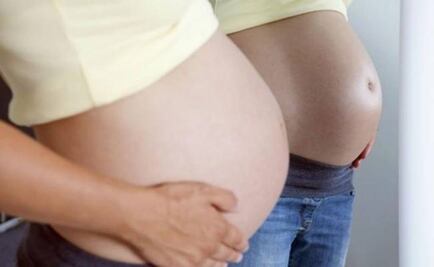 Zika-exposed babies born without microcephaly in Yucatán