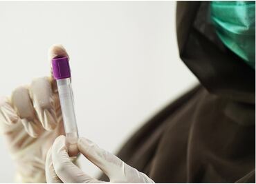 Edomex no ha registrado casos de hepatitis: Secretaría de Salud