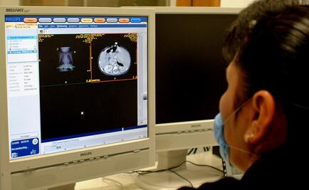 INCan logra supervivencia de pacientes con cáncer en un 60 y 80%