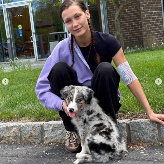 Bella Hadid mostró como fue su proceso con la enfermedad de Lyme. / Foto: Instagram.