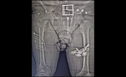 Con rayos X, detectan paquetes de marihuana en visita a penal de Puebla