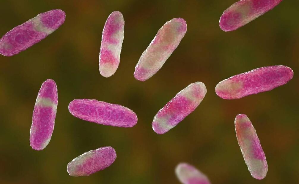 Preocupación sanitaria por la bacteria Klebsiella oxytoca. Foto: Pixabay