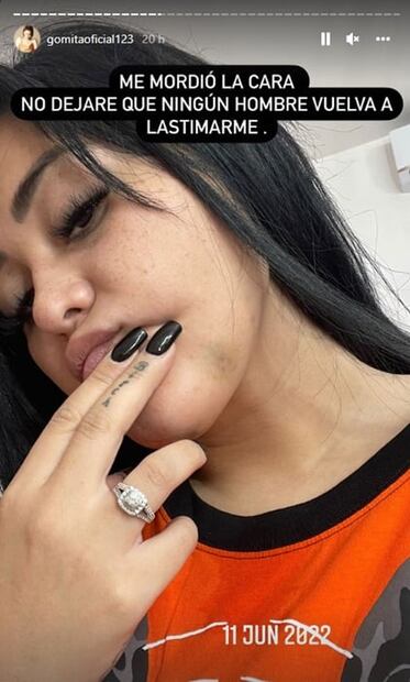 Gomita denuncia públicamente a su expareja por haberla golpeado: "Me defendí como pude"
