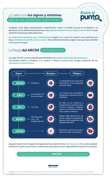¿Cuáles son los signos y síntomas del cáncer de piel tipo melanoma?