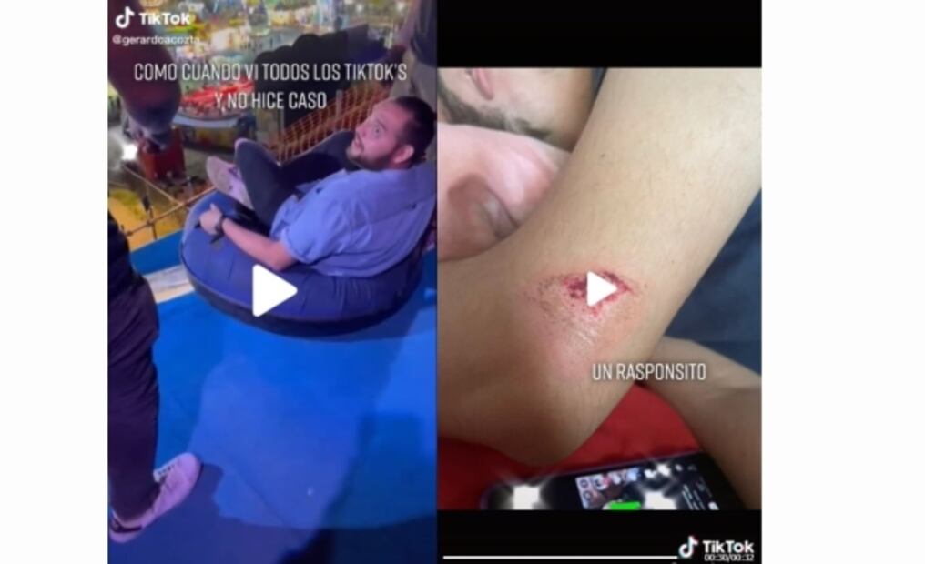 “Rampa Xtreme” de feria en NL los deja adoloridos, con collarín y raspones:TikTok