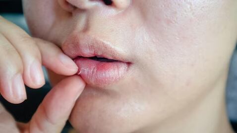 Cómo reparar los labios agrietados por el frío