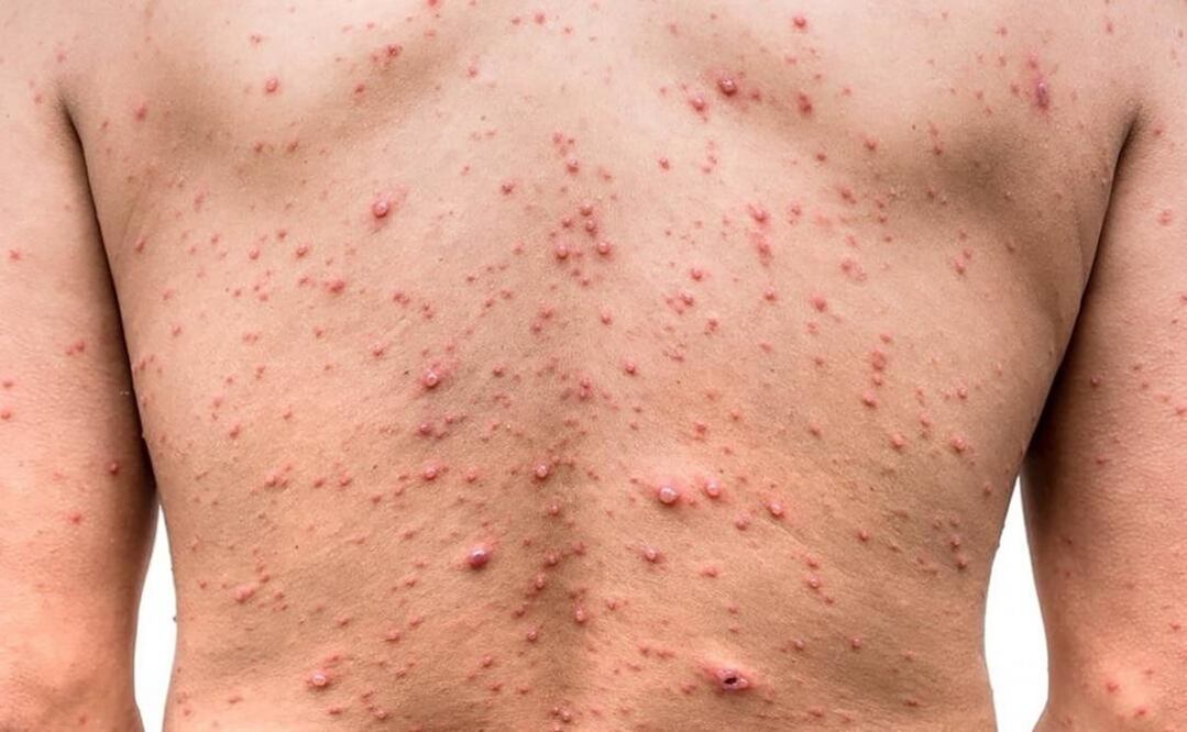 Foto: Archivo / EL UNIVERSAL