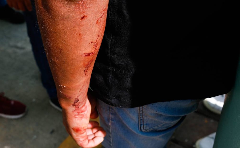 Foto: Cuartoscuro/El Universal