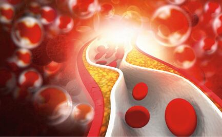 "Es más difícil tener una trombosis que un accidente automotriz": Alejandro Macías 