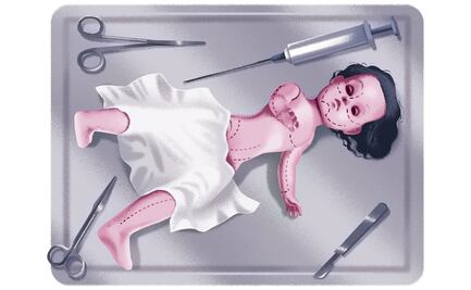 México, en el top de cirugías estéticas en menores; urgen cerrar vacíos legales