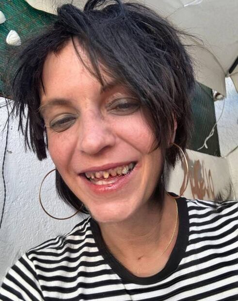 Camilo Blanes, hijo de Camilo Sesto se muestra en Instagram en mal estado.