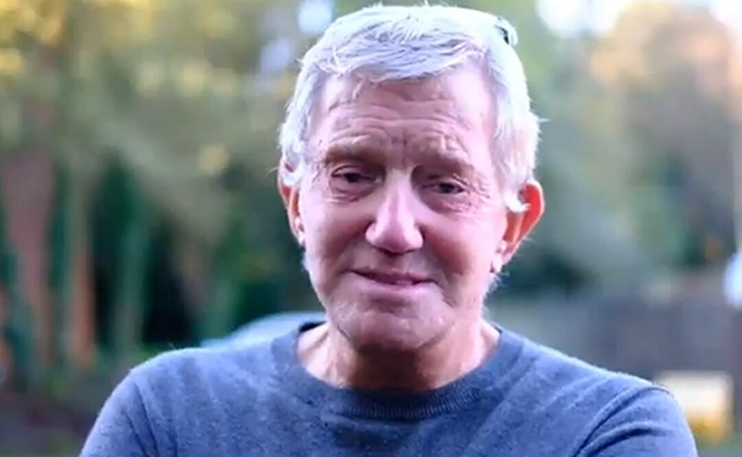 El hombre no puede cerrar correctamente sus ojos desde hace tres años. Foto: Tomada de video