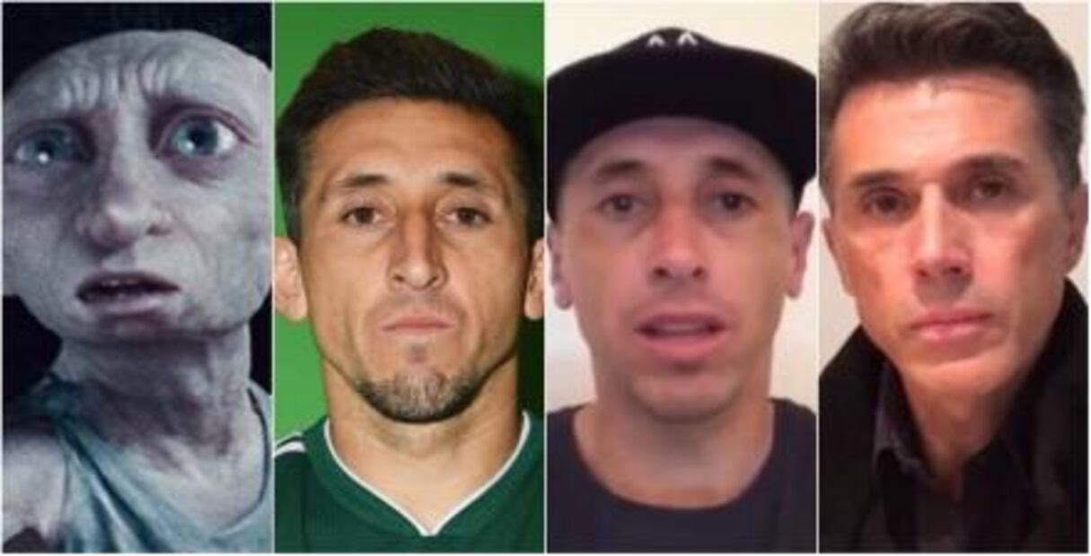 Los memes de Héctor Herrera por su cirugía de nariz y orejas