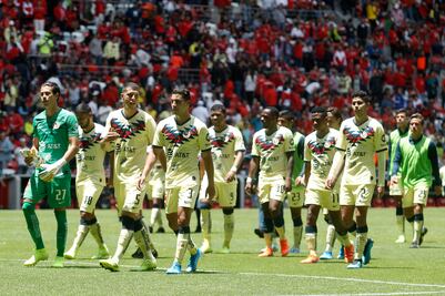 El América no resistiría otra baja