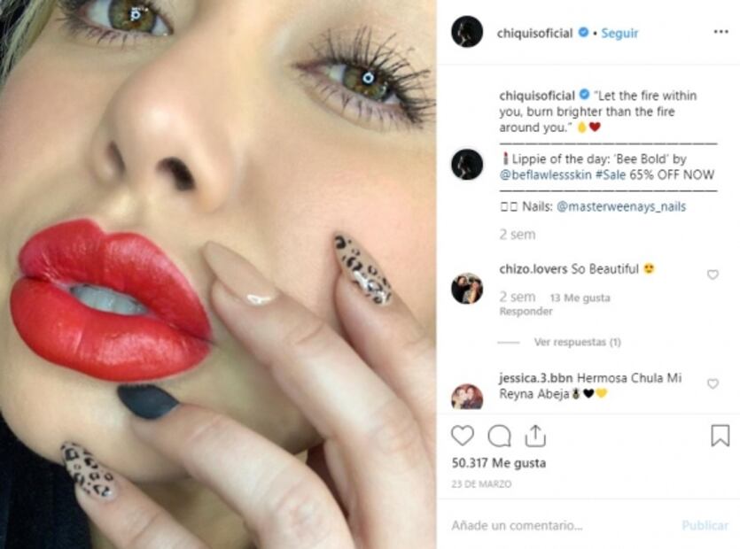 ¿Qué pasa con los labios de Chiquis Rivera? 