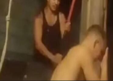 Recluta ruso se rompe un brazo para no ir a la guerra en Ucrania