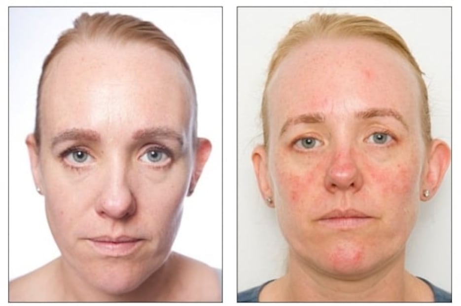 Conoce la importancia de lavarse la cara antes de dormir