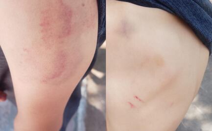 Agreden físicamente a menor resguardado en Casa del Niño DIF en Pachuca; responsabilizan a encargado de seguridad