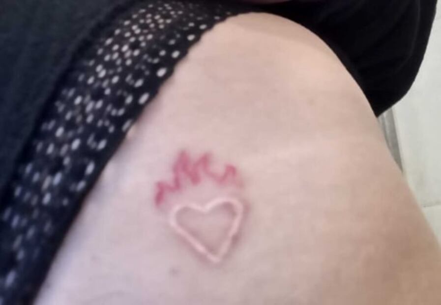 ¿Qué es más perjudicial para la salud, tapar un tatuaje o removerlo? 