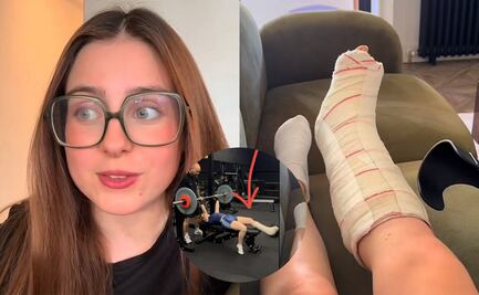 ¿Fingió su lesión?; Roro desata polémica por cambio de pie fracturado en sus videos