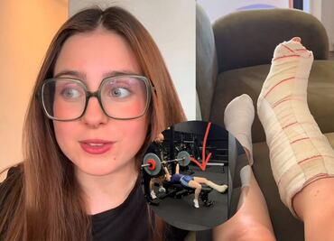¿Fingió su lesión?; Roro desata polémica por cambio de pie fracturado en sus videos