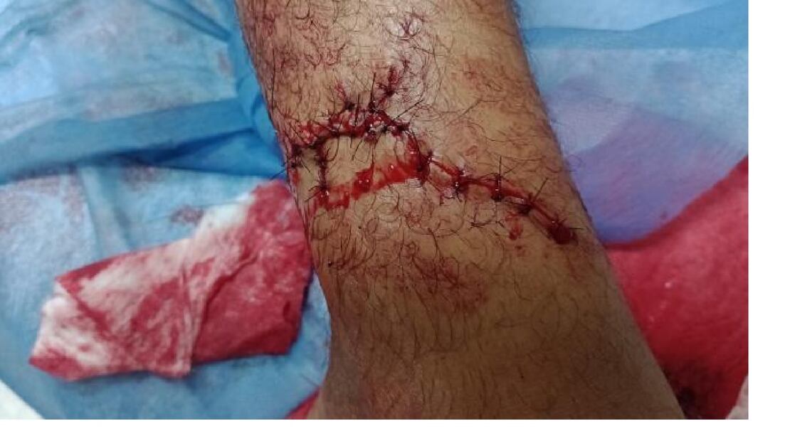 Cristian Castaño fue trasladado al hospital, con heridas en varias partes del cuerpo. FOTO: CORTESÍA