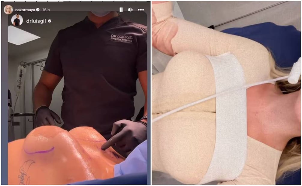 La youtuber Maya Nazor se puso implantes mamarios y se sometió a una liposucción en los brazos.