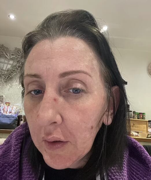 Mujer se vuelve viral por su increíble transformación física tras divorciarse