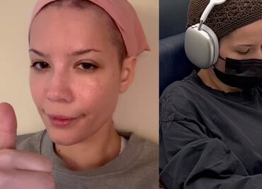 Cantante Halsey revela que padece lupus y leucemia en su nuevo sencillo: "tengo suerte de estar viva"