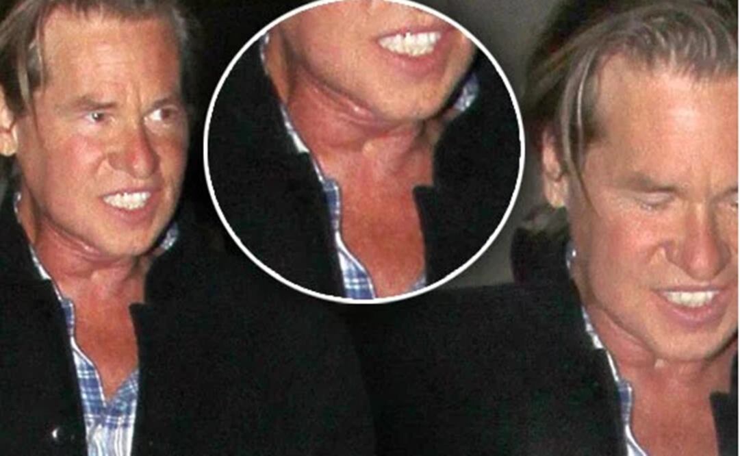 Fue visto en un evento público en California hace unos días FOTO: RADAR ONLINE