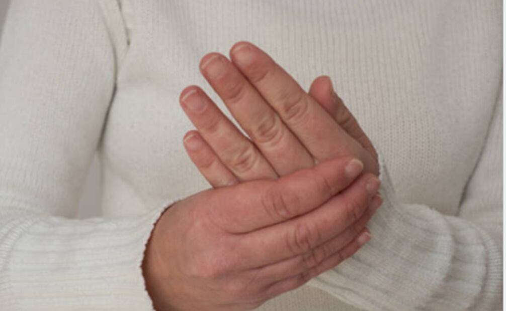 Lupus. Foto: Pixabay