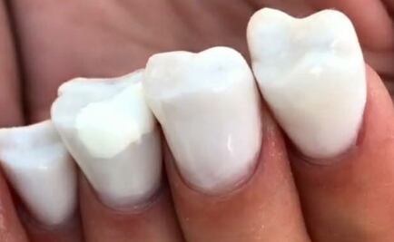 Crean uñas con forma de dientes y se vuelve viral