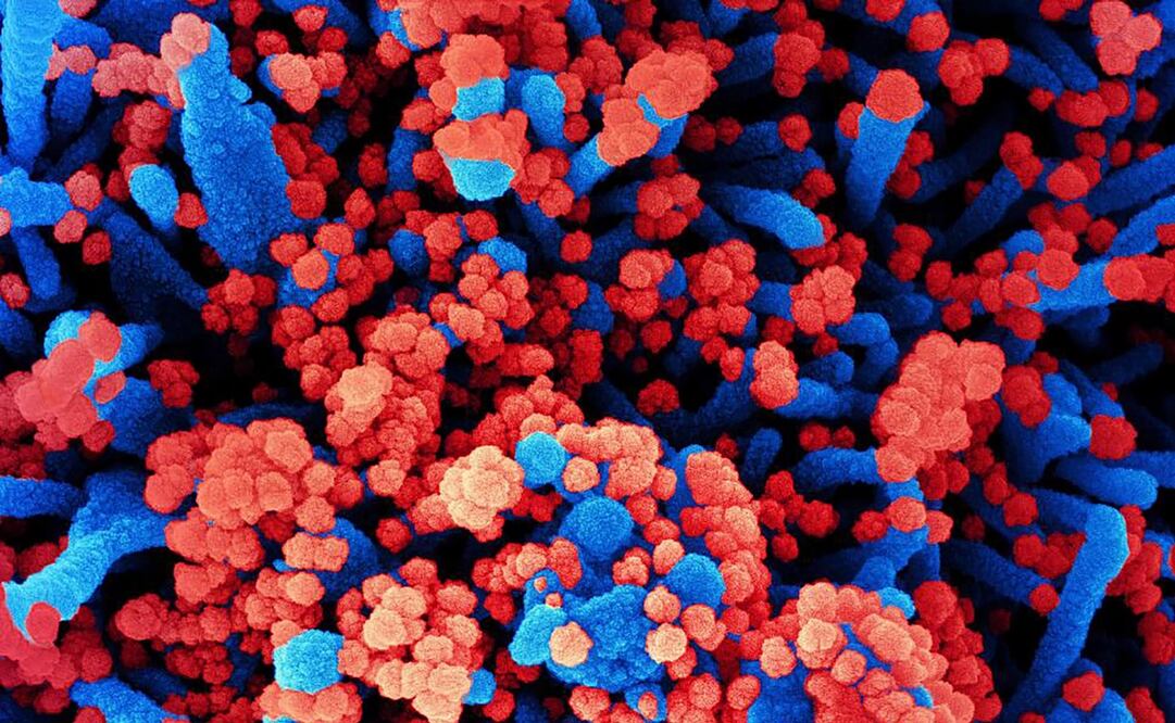 Foto: National Institute of Allergy and Infectious Diseases / AFP