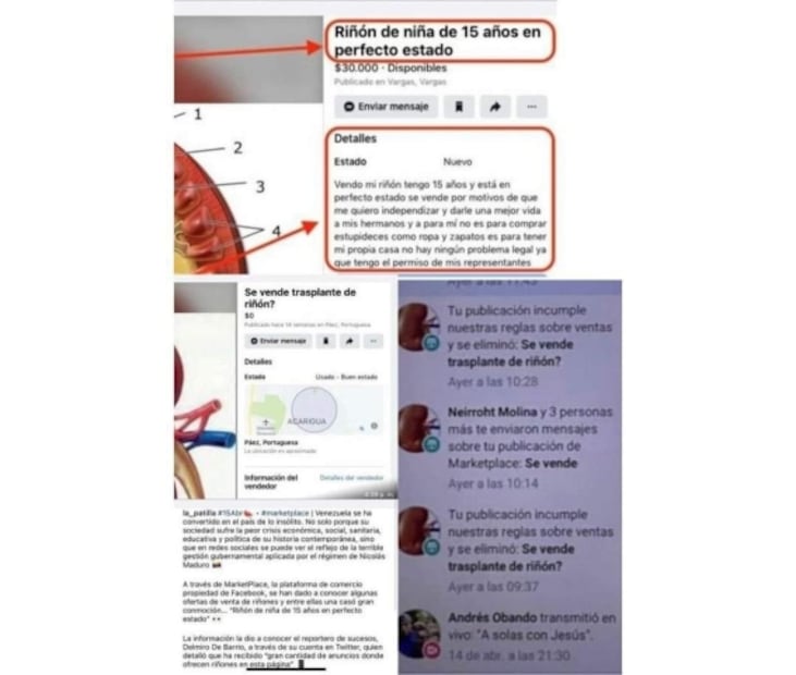“Riñón de niña de 15 en perfecto estado”, cae mujer por traficar órgano en 400 mil pesos por Facebook