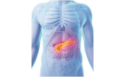 El 26% de los casos de diabetes tipo 3c son causados por cáncer de páncreas