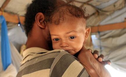 Randa, la niña de 3 años que pesa 4 kilos y está al filo de la muerte por desnutrición en Yemen