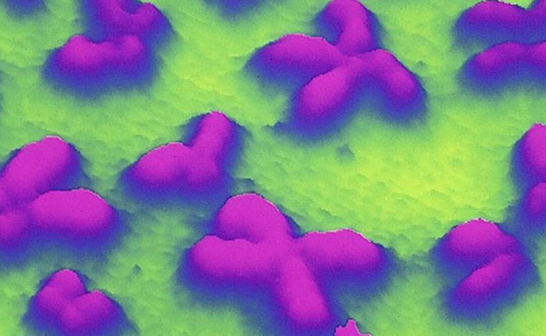 El objetivo es diseñar tratamientos de logopedia específicos para cada síndrome. Foto: Archivo