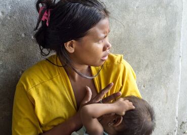 Los 3 países con más hambre en América Latina