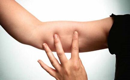 ONG obsequia implantes anticonceptivos a mujeres migrantes; buscan dar acceso a servicios de salud sexual