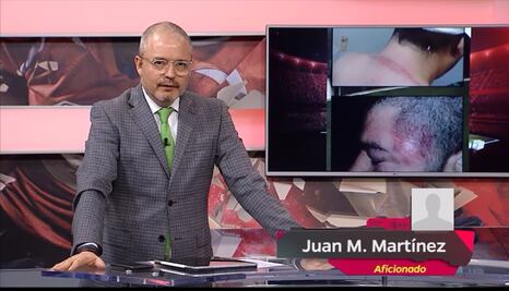 Aficionado revela detalles de la brutal golpiza que le dio seguridad del estadio de Chivas