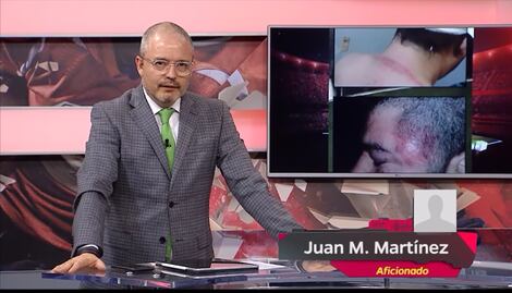 Aficionado revela detalles de la brutal golpiza que le dio seguridad del estadio de Chivas