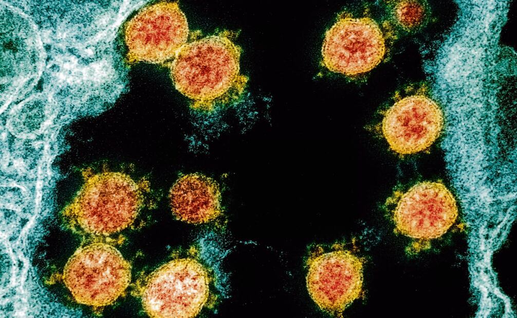 Nueva variante Covid-19. Foto: National Institutes of Health vía AP