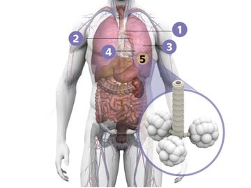 Además del tabaco, ¿qué provoca el cáncer de pulmón?