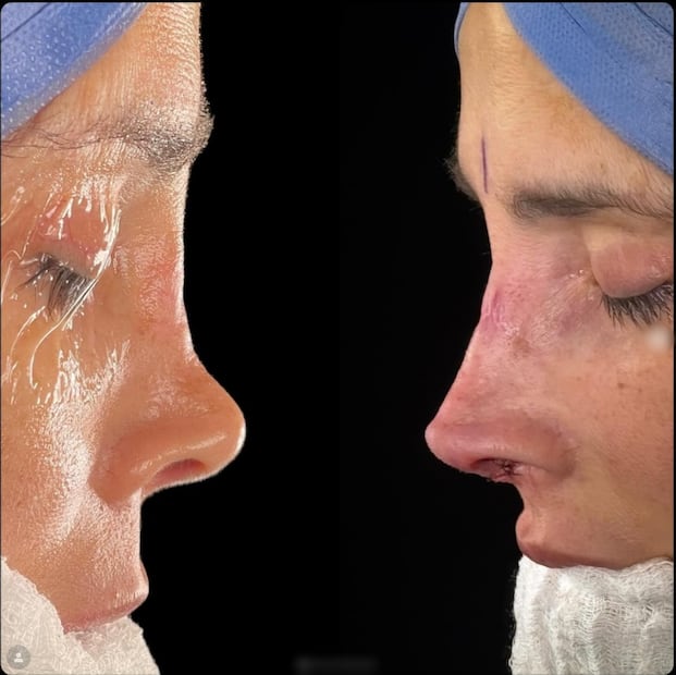 Dorismar muestra el antes y el después de su cirugía reconstructiva.