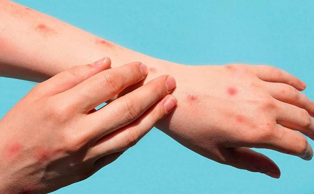 Foto: Archivo/EL UNIVERSAL