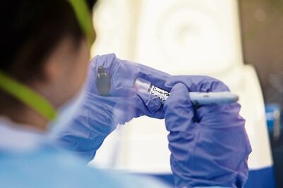 No existen riesgos de contagio de influenza aviar en México, afirma Secretaría de Salud