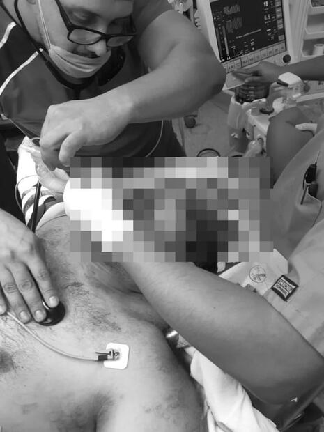 Pierde el ojo hombre acuchillado por pelear cajón de estacionamiento