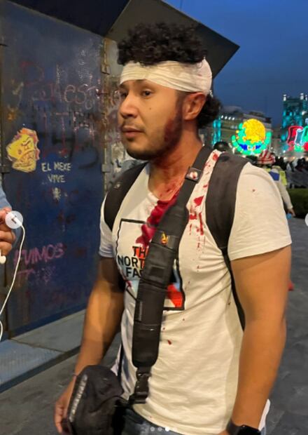 Fotoperiodista Juan Abundis y miembro de Obturador Mx, fue otro de los agredidos durante la manifestación del 2 de octubre. Foto: Tomada de obturadormx