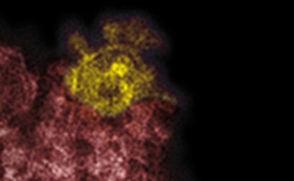 Proteína pico del coronavirus puede causar por sí sola daños pulmonares